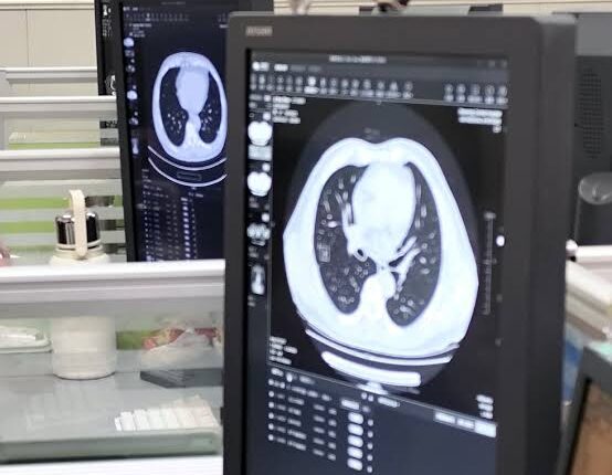 Scientists Develop AI Model to Predict Diseases Years in Advance