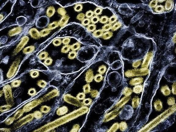 Washington State Reports Suspected Bird Flu Case, First Possible U.S. Infection in 9 Months